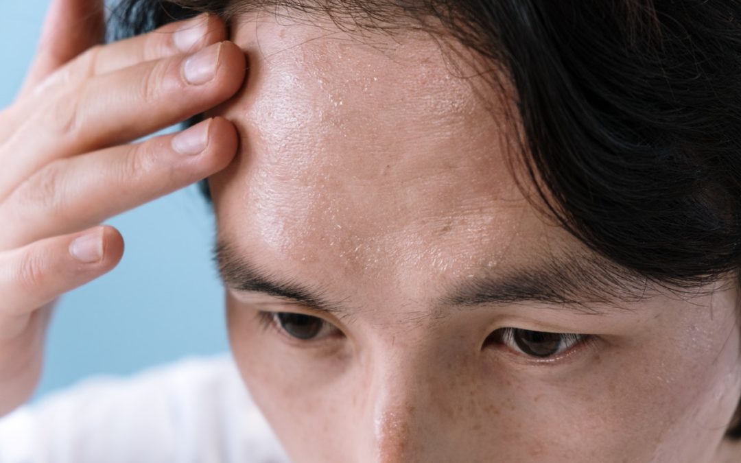 5 astuces naturelles pour réduire les rides du front